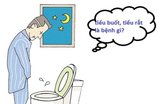 [Tổng hợp] Tiểu rắt là gì? Nguyên nhân gây bệnh tiểu rắt ở nam và nữ ...