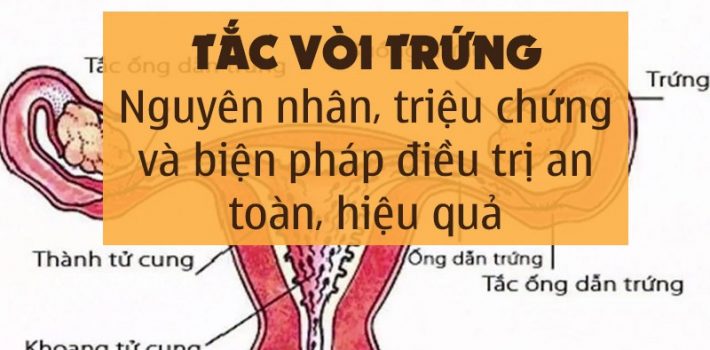 tac-voi-trung-la-gi-nguyen-nhan-chuan-doan-va-cach-chua