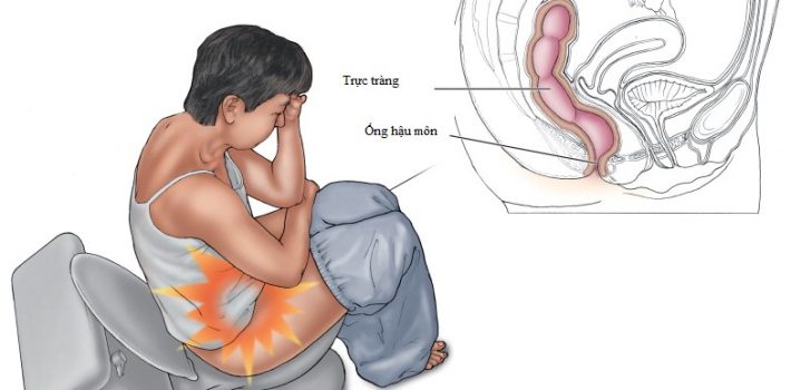 dau-hau-mon-la-bi-benh-gi-nguyen-nhan-va-cach-chua